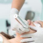 OPATRA LONDON in Zürich – Erfahrungen mit professionellem Microneedling